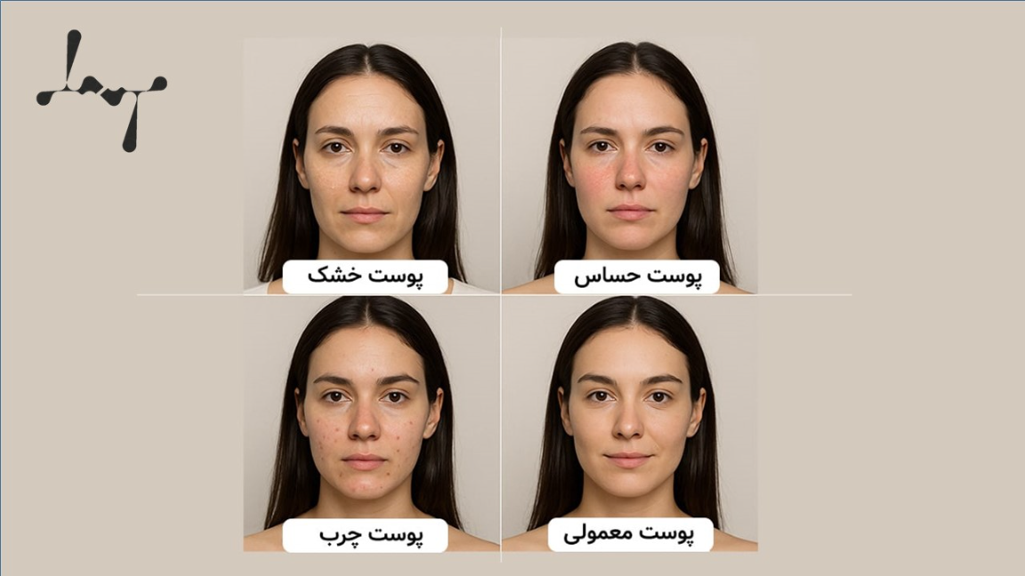 شناخت انواع پوست