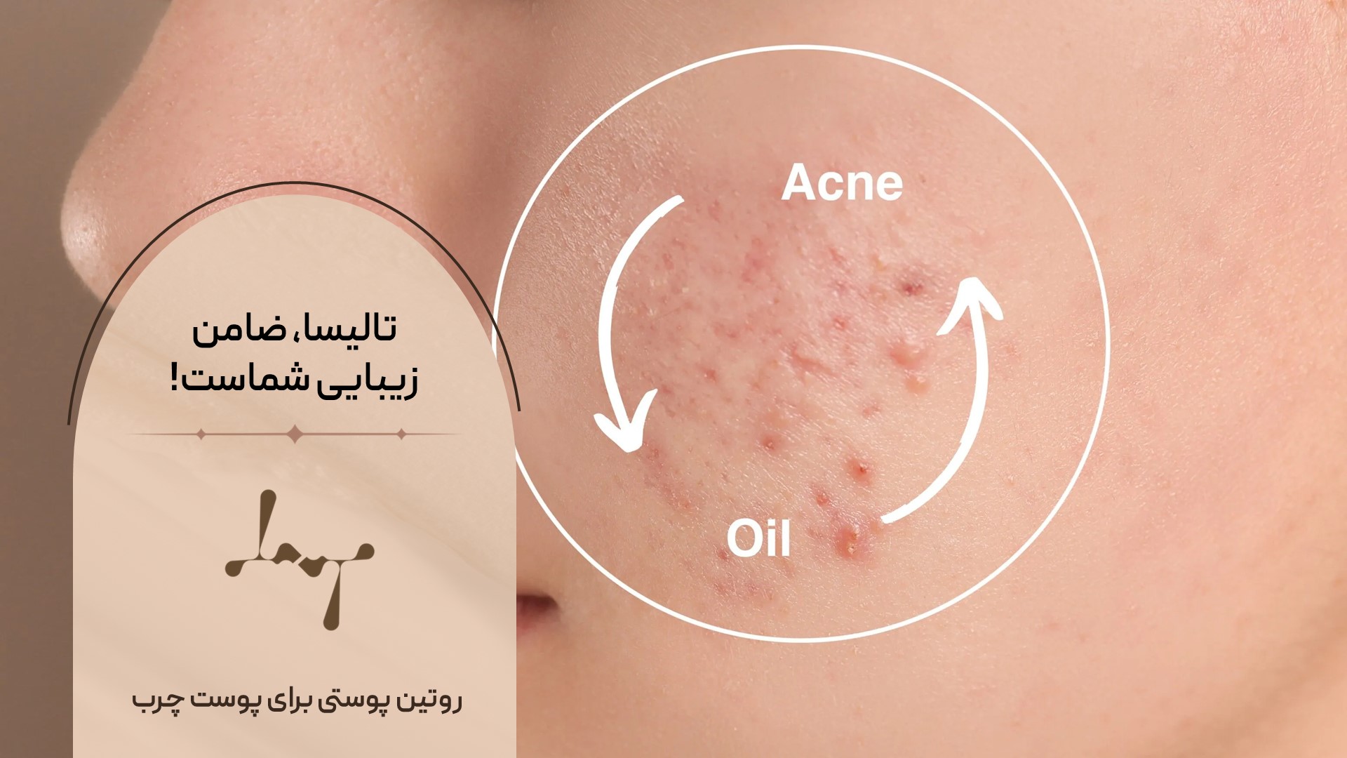 روتین پوستی مناسب پوست چرب